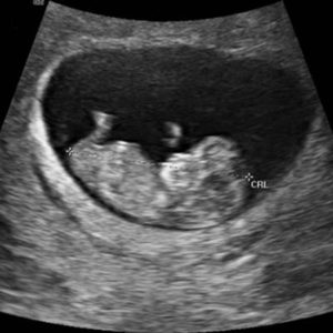 prenatal questions