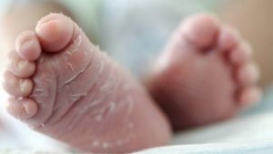 Newborns peeling feet